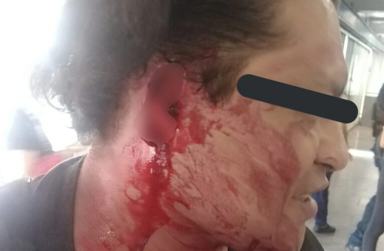 Presunto acosador pierde la oreja durante riña en el metro Xola