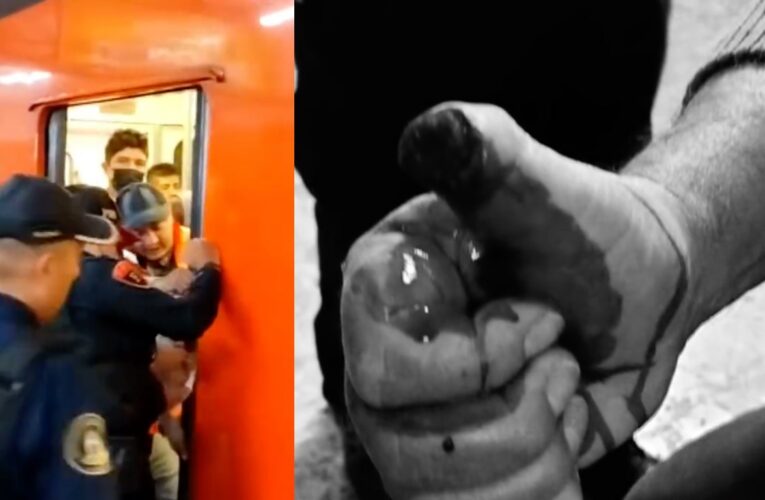 Amputan dedo de abuelito, se le atoró en el Metro