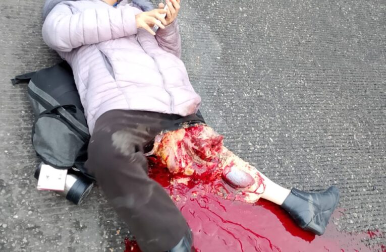 Imprudencia de Pipero Causa la Muerte de una Mujer en Estación del Mexibús en Ecatepec