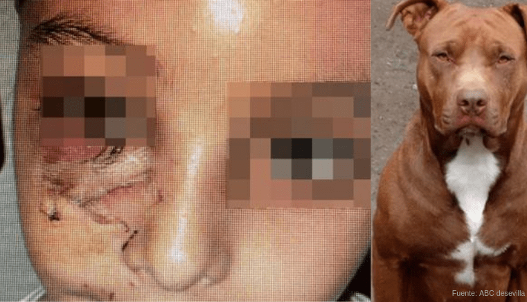 VIDEO | ¡Pitbull desfigura a niño de 4 años en su propia casa!