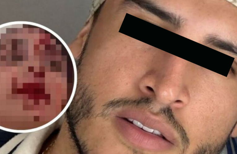 ¡ESCÁNDALO Y SANGRE EN CANNES: DETIENEN A FAMOSO ESTILISTA POR BRUTAL AGRESIÓN A MODELO!